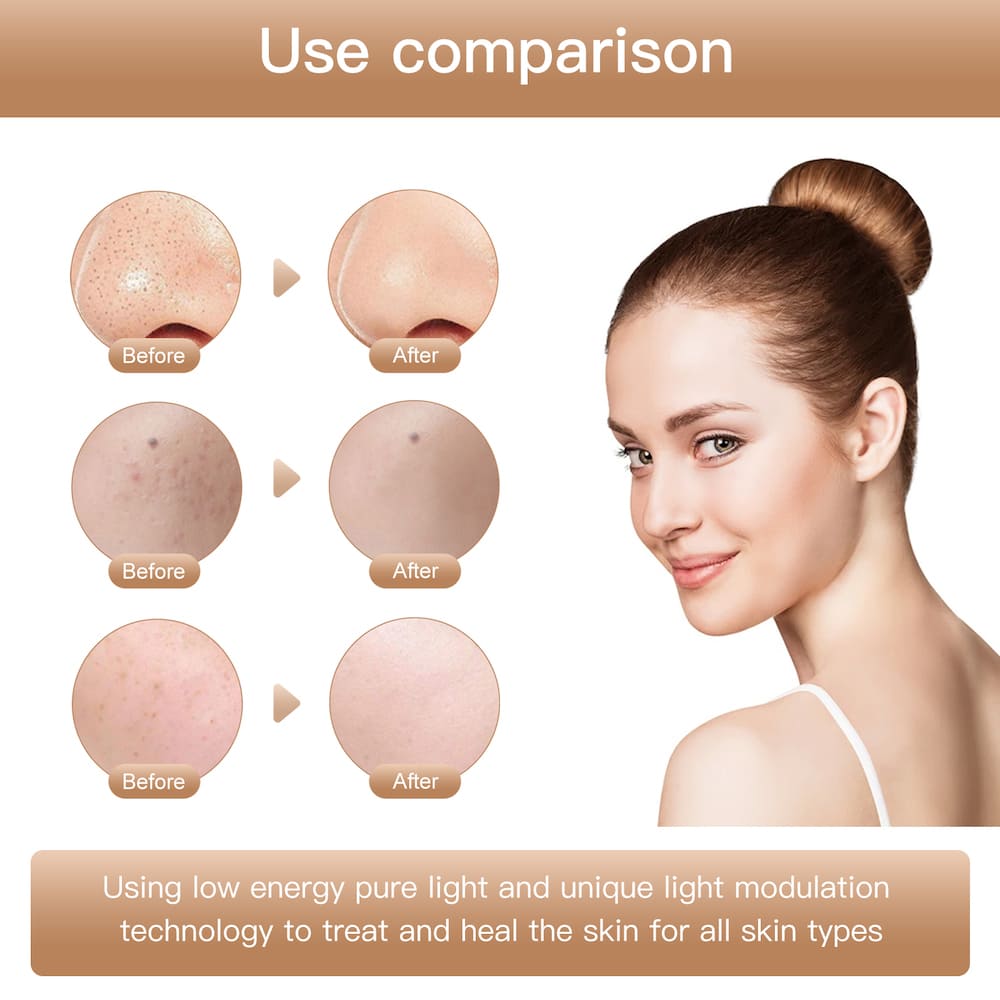 beauty face mask with photon therapy against wrinkles for the face