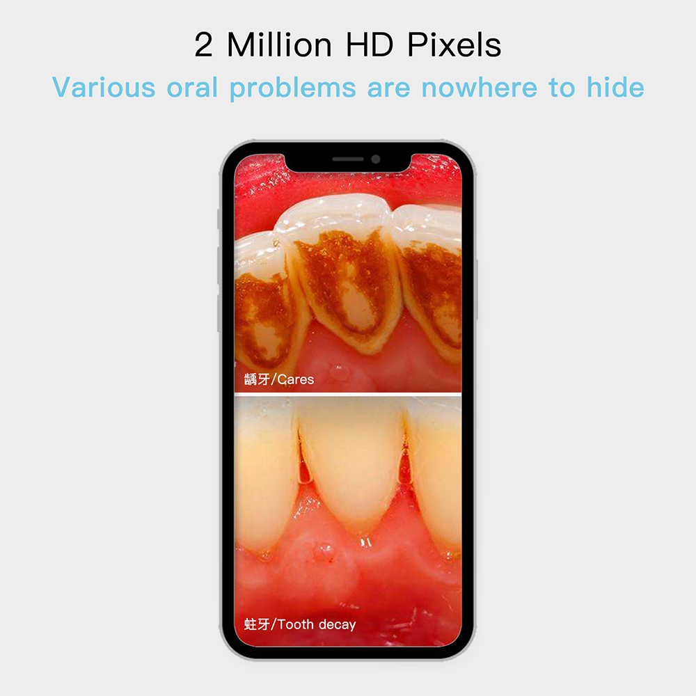 teeth camera full hd oral dental cam