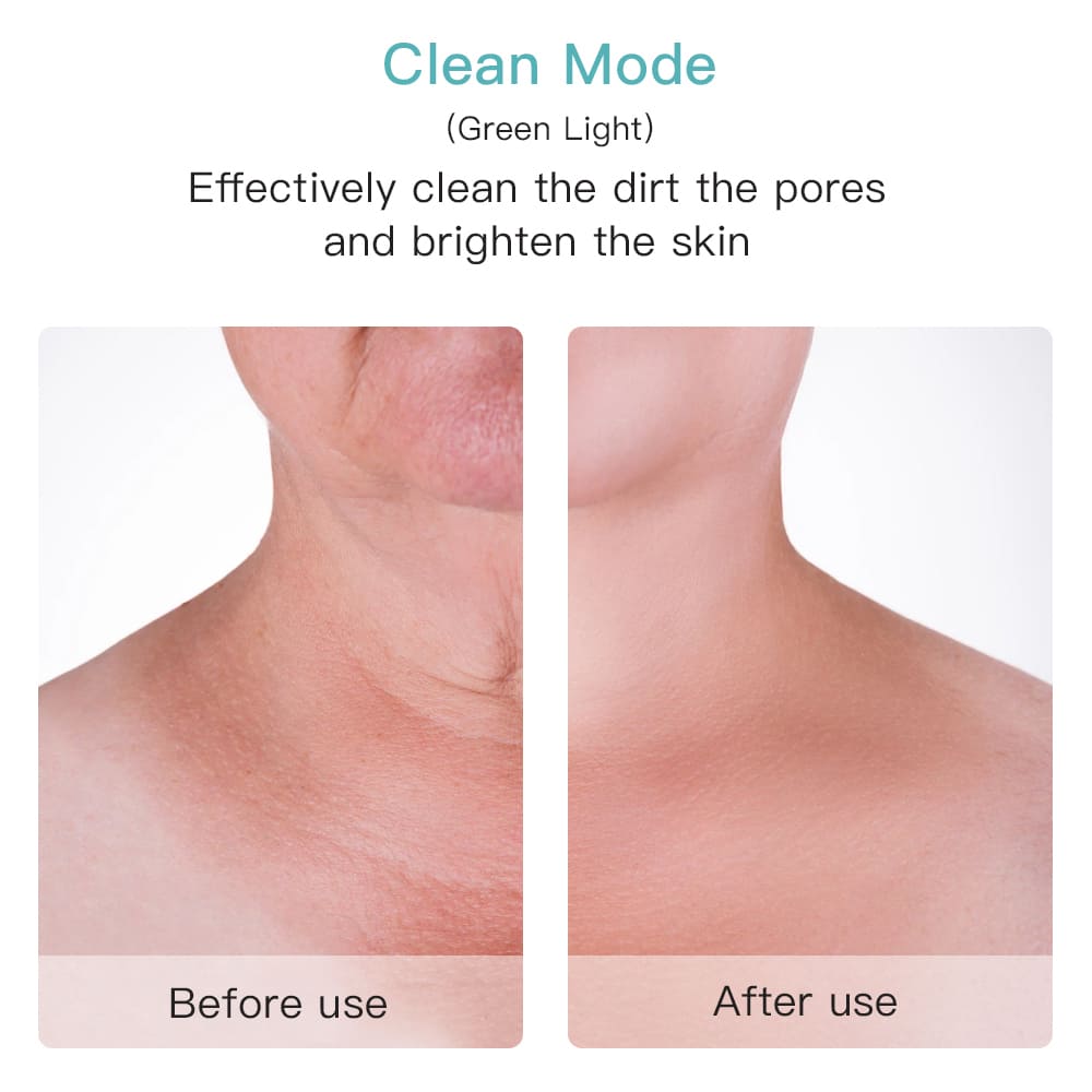 Effective pore cleaner on the face or neck before after