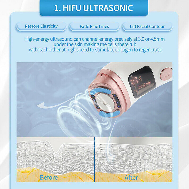 hifu ultrasound